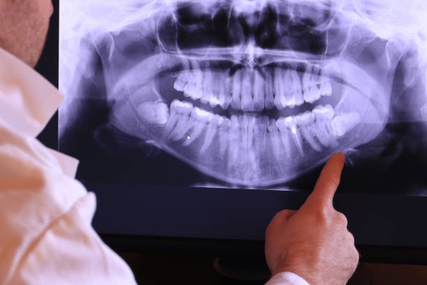Best Emergency Denture Repair in Rolla, MO