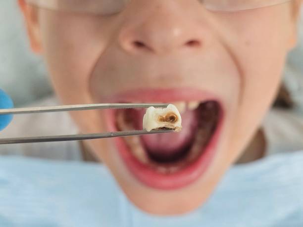Best Cosmetic Emergency Dentistry in Rolla, MO